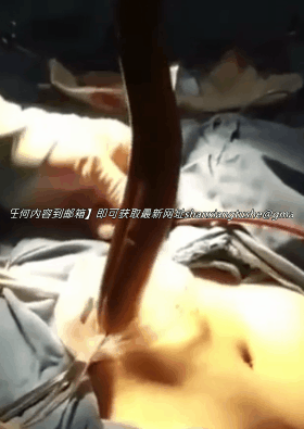 图片[1]-【特殊资源】当年火遍全网的黄鳝门事件，相信大家都看过了-山相欢迎您！