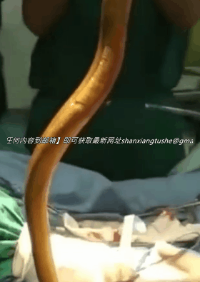 图片[5]-【特殊资源】当年火遍全网的黄鳝门事件，相信大家都看过了-山相欢迎您！